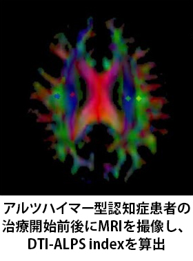 pr202510_oura01