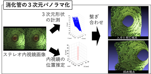 消化管の３次元パノラマ化