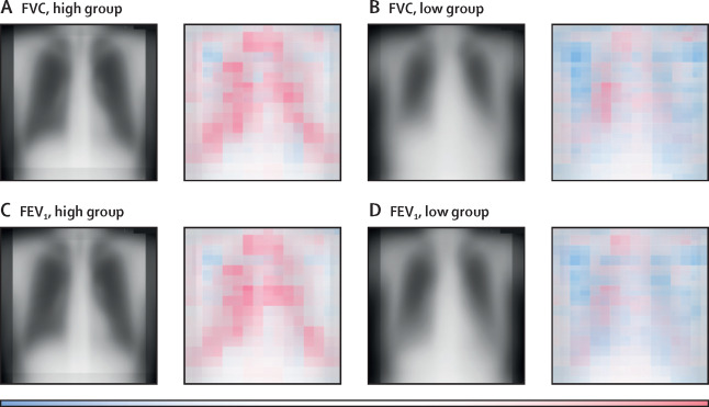 Multi-Institutional Study of Deep Learning Model for Estimating Pulmonary Function from Chest X-rays