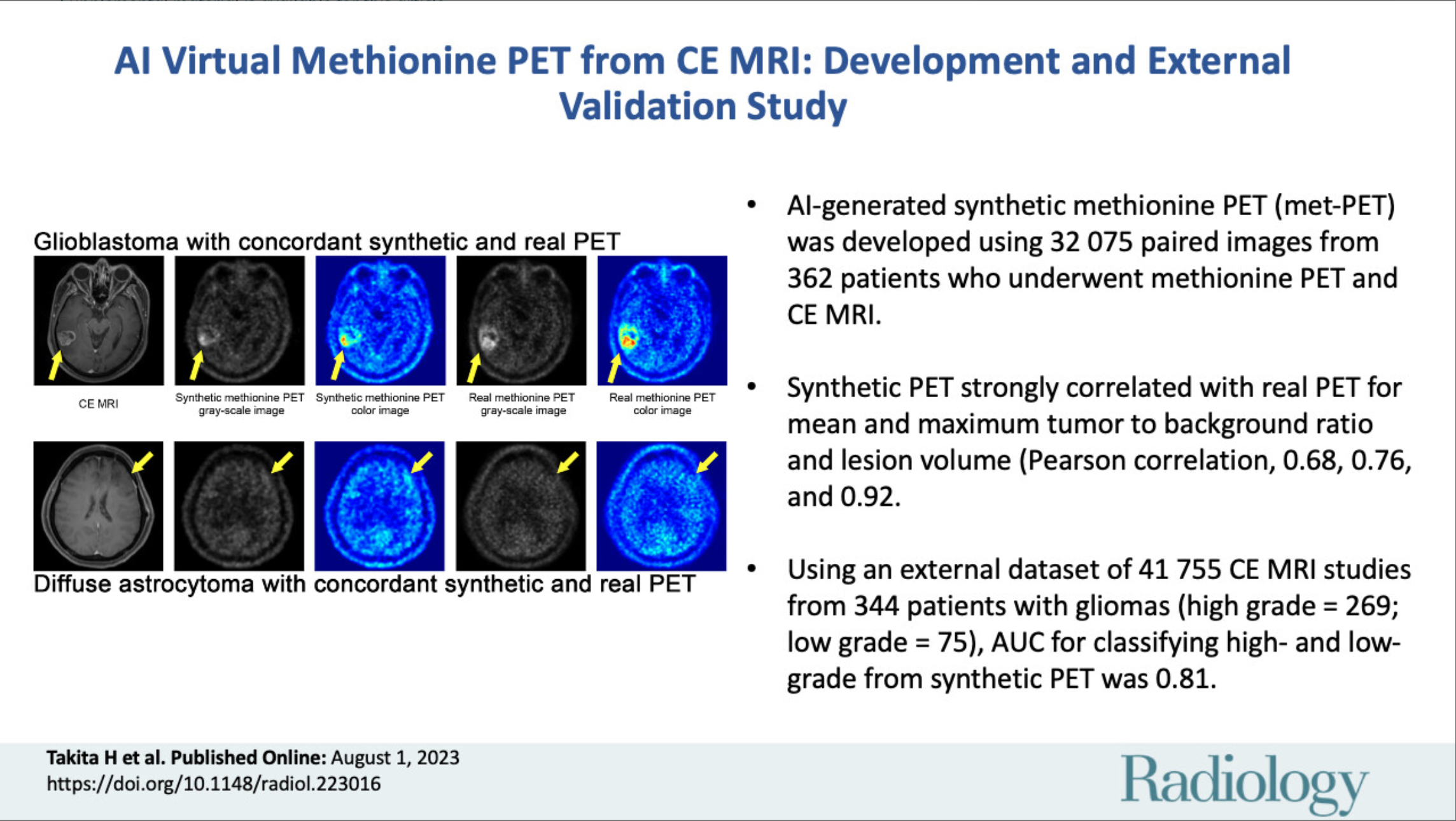 Creation and Validation of AI for Synthesizing Methionine PET from Contrast-Enhanced MRI