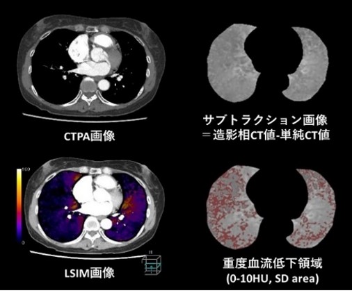 cardiovascular-4