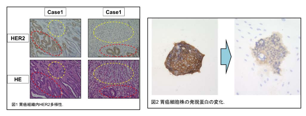 腫瘍内不均一性と抗癌剤耐性研究