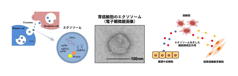 エクソソーム癌微小環境研究