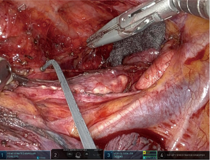 esophagus-05