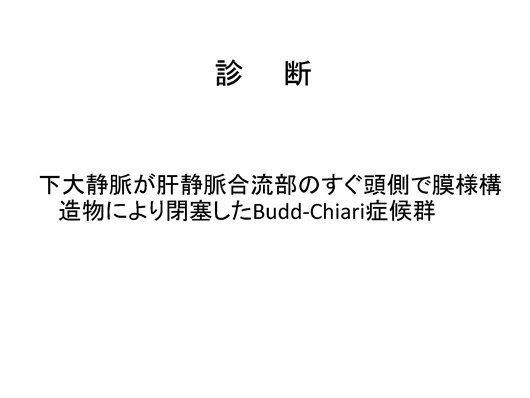 バッドキアリ症候群のエコー像