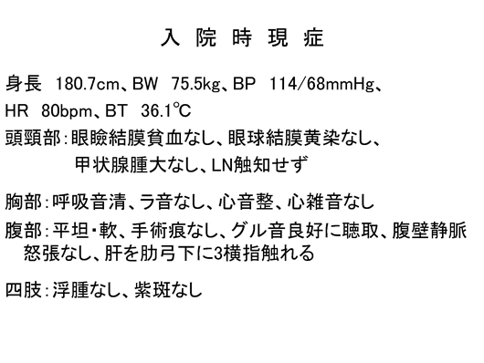 バッドキアリ症候群のエコー像