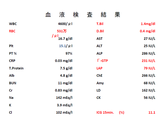 バッドキアリ症候群のエコー像