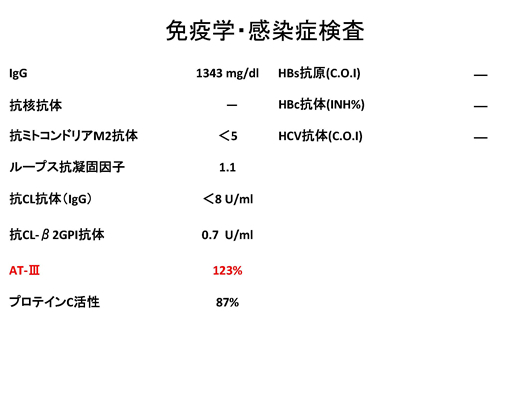 バッドキアリ症候群のエコー像