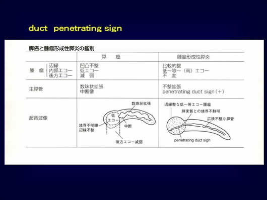 腹部超音波の用語