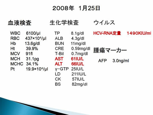 肝のう胞内出血が疑われた2例