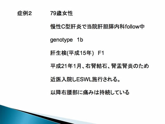 肝のう胞内出血が疑われた2例