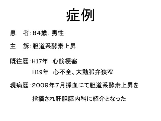 膵臓の描出のコツ、みかた、MPD拡張