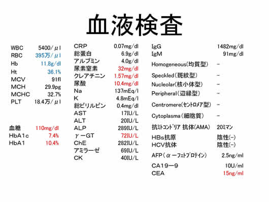 膵臓の描出のコツ、みかた、MPD拡張