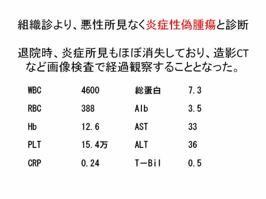 肝内多発SOLの1例