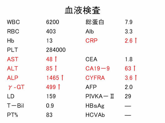 肝内多発SOLの1例