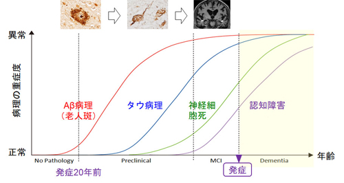 図1.アルツハイマー病の脳病理の出現から発症まで