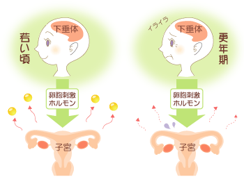 更年期障害イラスト02