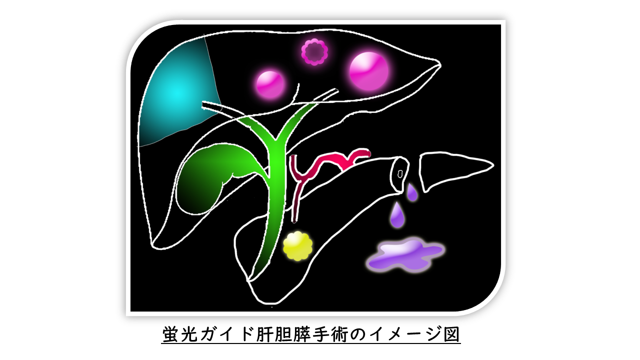 スライド3
