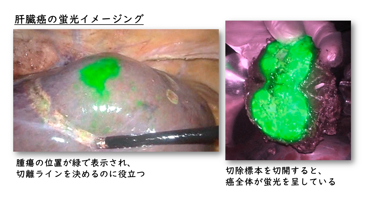 スライド5