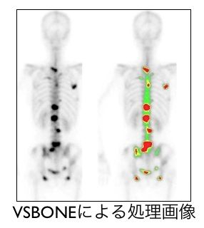 photo-byoutai-nuclearmedicine-03