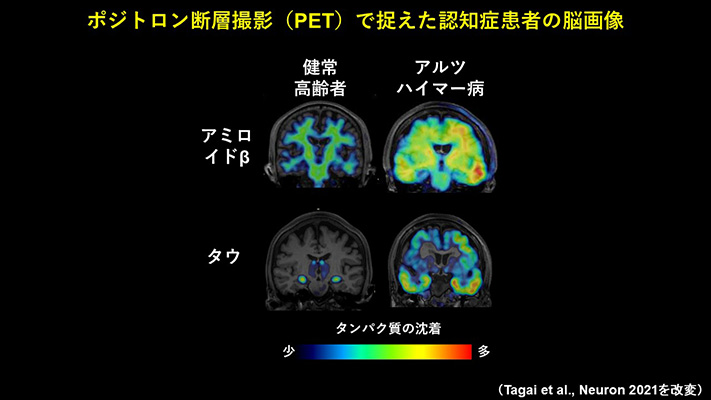 omuom_higuchi_2-1