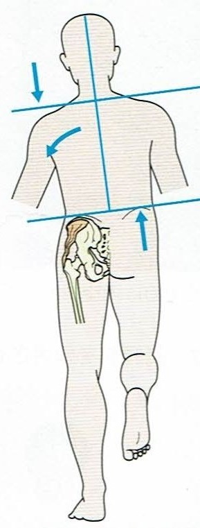 DuchenneGait