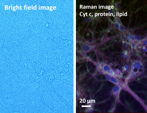 BF-Raman