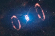 SN1987A